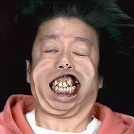 老王吃瓜牙流血,揭秘瓜果安全食用指南